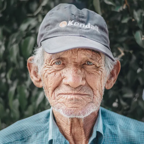 Artrose do Cotovelo - Dr. Marcos Rassi